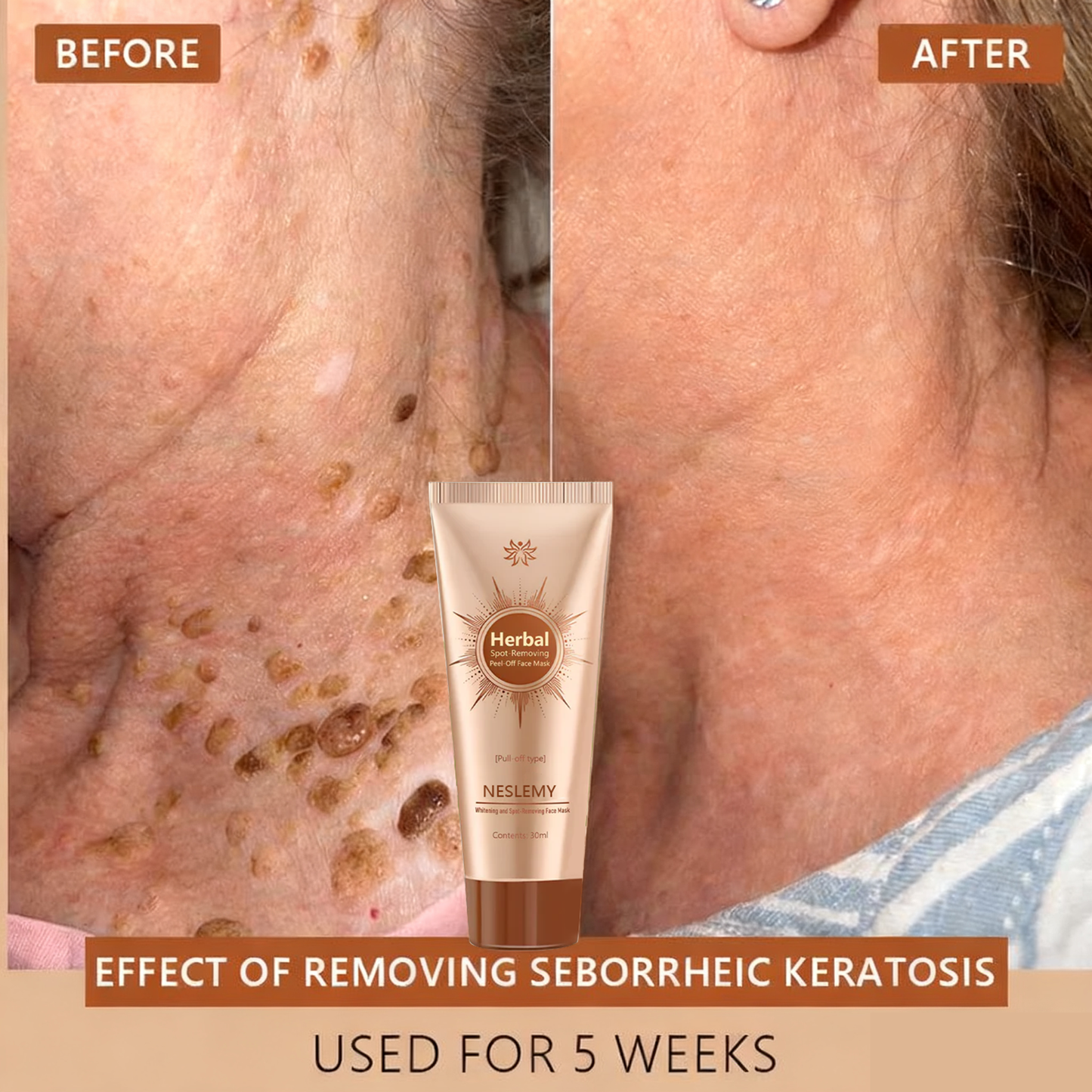 Whitening and Spot-Removing Face Mask Suitable for face and body – 👩‍⚕️ Natural ingredients permanently remove age spots, freckles, sun spots, and liver spots.